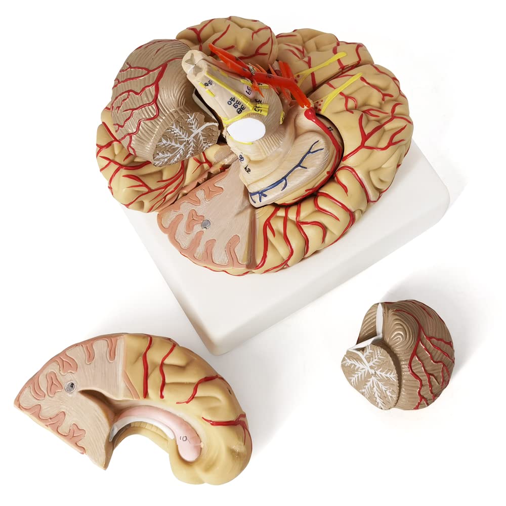 Snapklik.com : Evotech Human Brain Model w/Arteries, 9 Parts Life Size ...