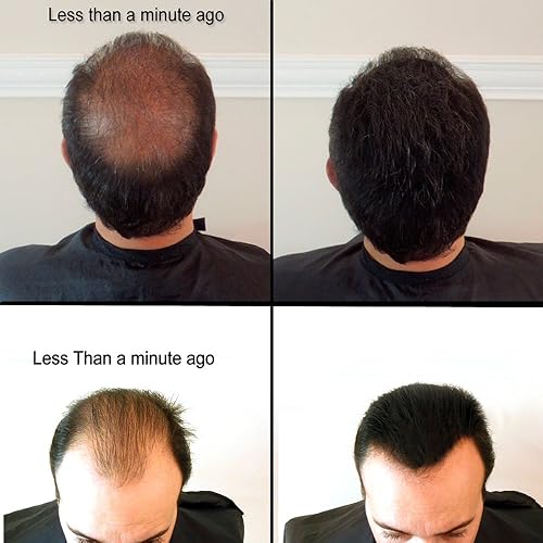 Samson - Recambio de fibra capilar de 3.53 onzas, para ocultar la pérdida de cabello, Estados Unidos, adecuado para todas las marcas (marrón oscuro)