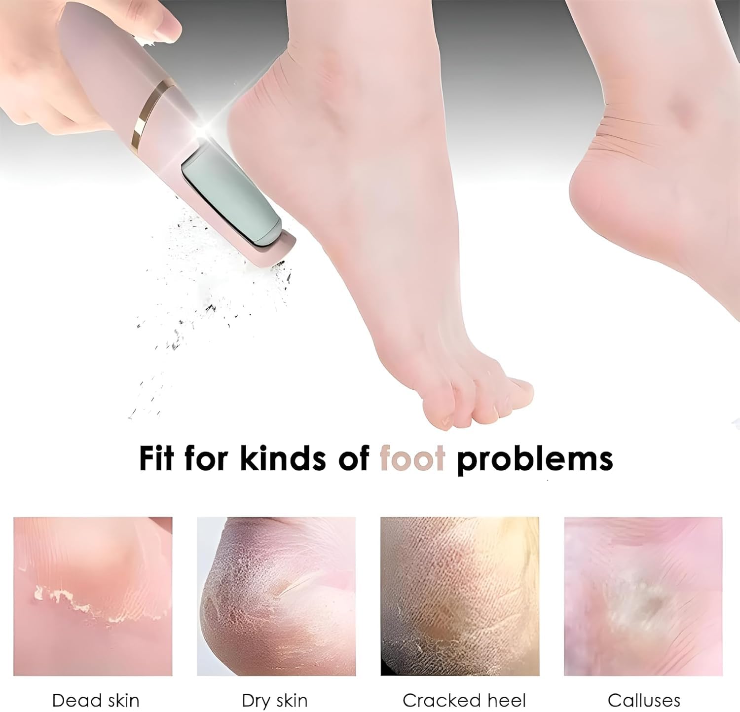 Feelon Professional Callus Filer and Foot Scrubber Kit for Silky Smooth Feet - Pedicure Machine with Dead Skin Remover, Includes Pedicure Tools for Women 1