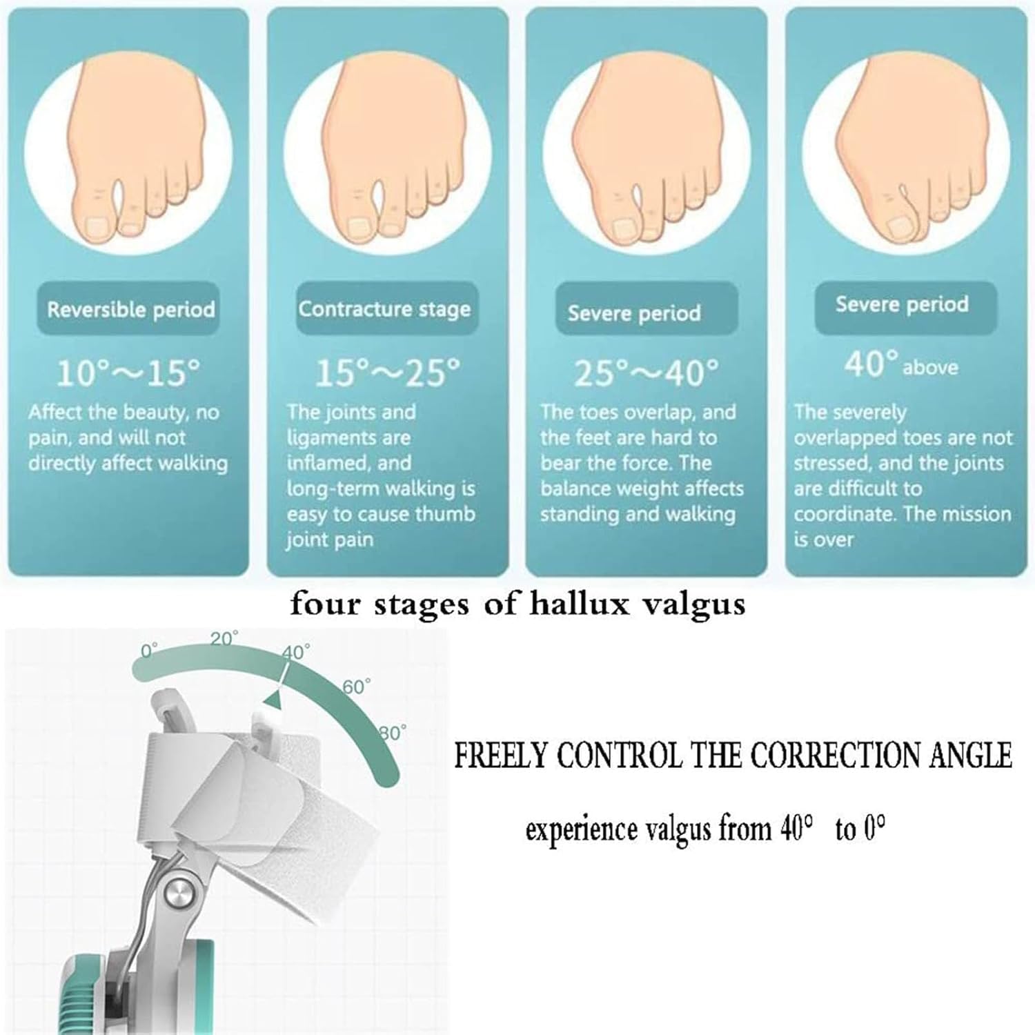 Ortesis para juanetes, enderezador del Dedo Gordo del pie, férula Ajustable para juanetes con corrección de Perilla, restauración del Arco Transversal Correcto, corrección del Hallux valgus