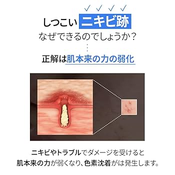Amazon | 【BLANC ブラン公式】カタツムリエキス含有高濃縮シカ
