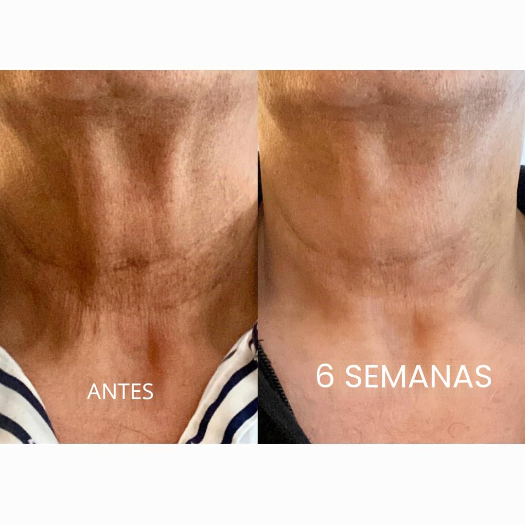 SkinRèmide Parches Antiarrugas de Silicona para alisar el escote