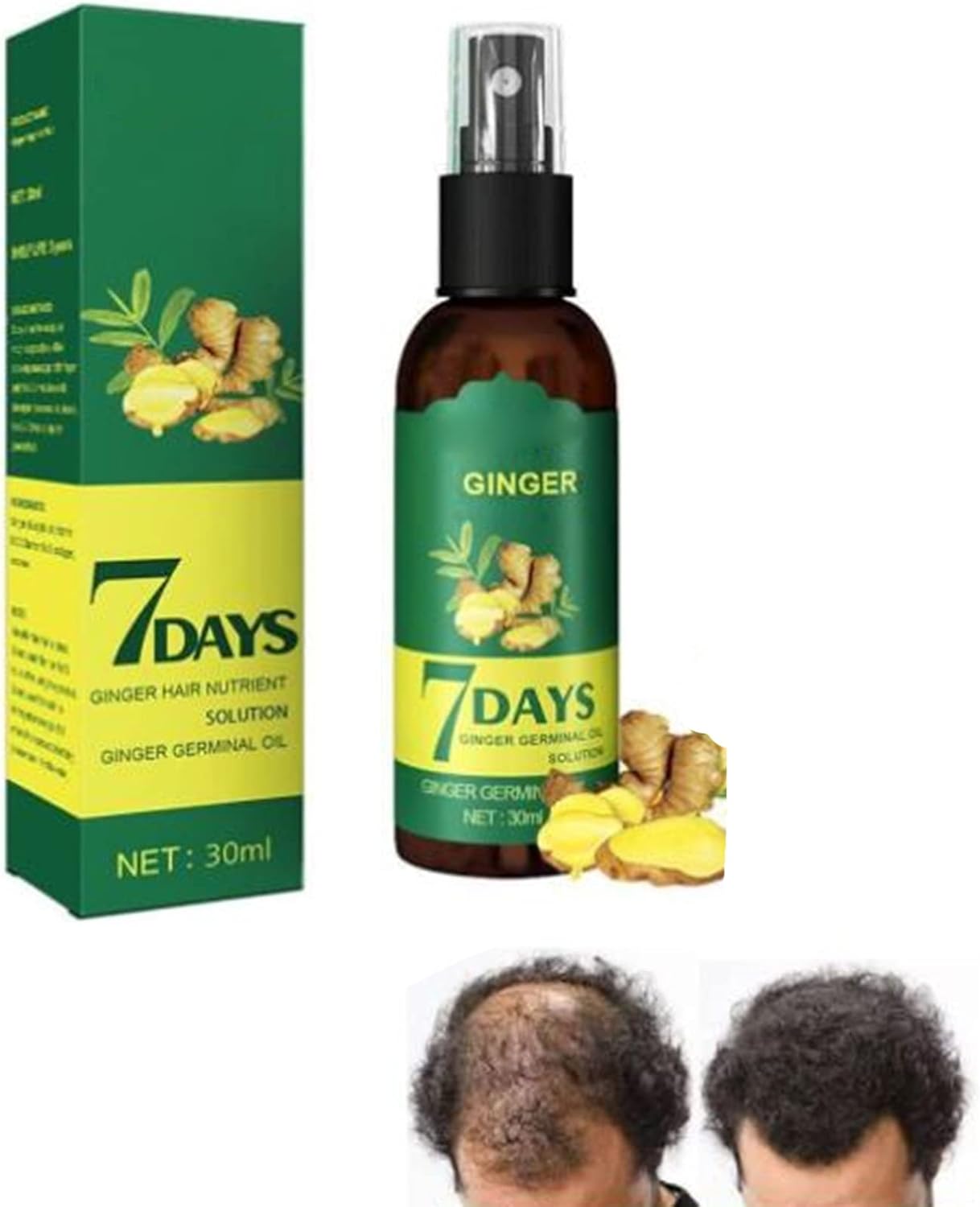 ShougaGRO Japanese Hair Growth Spray, HyunGang Korea Ginseng Hair