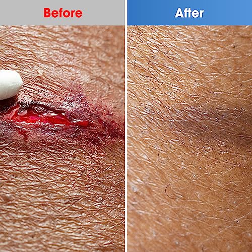 Ourmed Hydrocolloid Bandages Large 4" x 4", Extra Thin Waterproof Wound Dressing with Adhesive for Light Exudate Wound, Blister, Acne, Superficial Wound Care, 10 Pack, FSA HSA Eligible