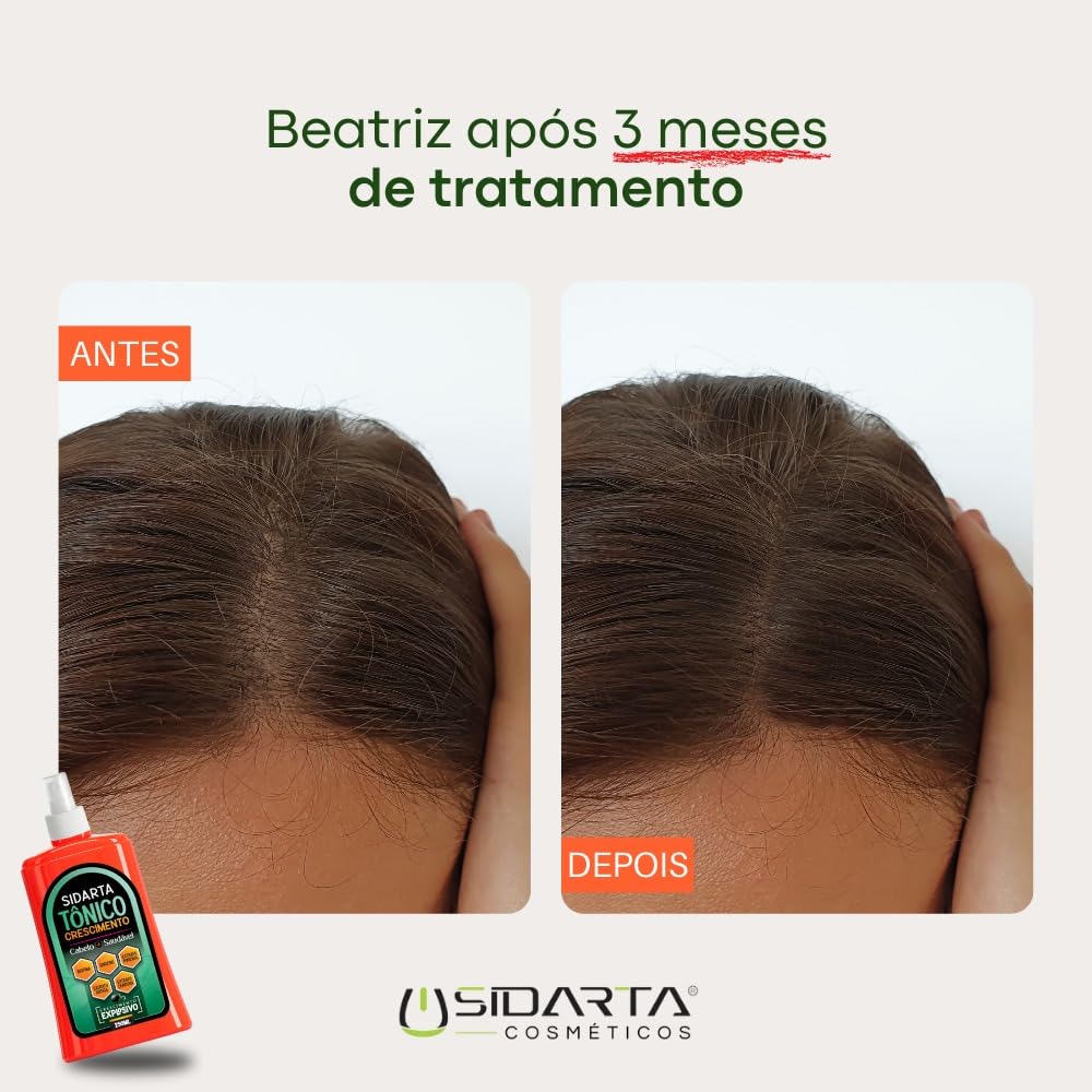 Super Tônico capilar crescimento, anti-queda e fortalecimento. em promoção! Veja a oferta e mais achadinhos de Óleos, Séruns e Tônicos 4 Hoje é o melhor dia para comprar Super Tônico capilar crescimento, anti-queda e fortalecimento. com aquele preço maroto! Promoção! Aproveite a oferta! 4