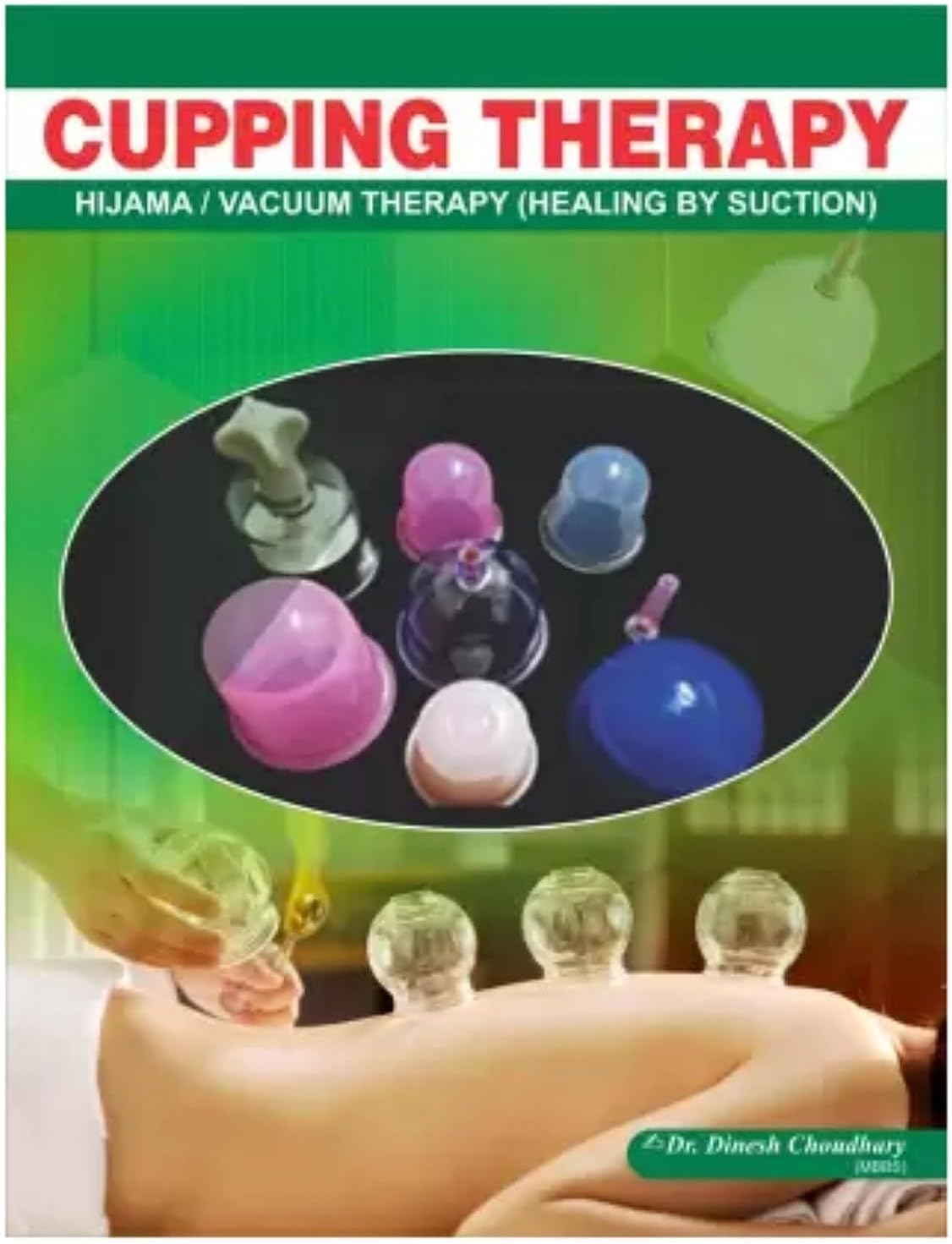 GM ACUPRESSURE(एक्यूप्रेशर) BOOKS IN ENGLISH, (Hijama Cupping Therapy-ENGLISH) Cupping (Hijama/Vacuum) Therapy Book - ENGLISH