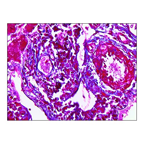 TRICHROME TTRULE MilliporeSigma TTR012-25EA standard d'excellence