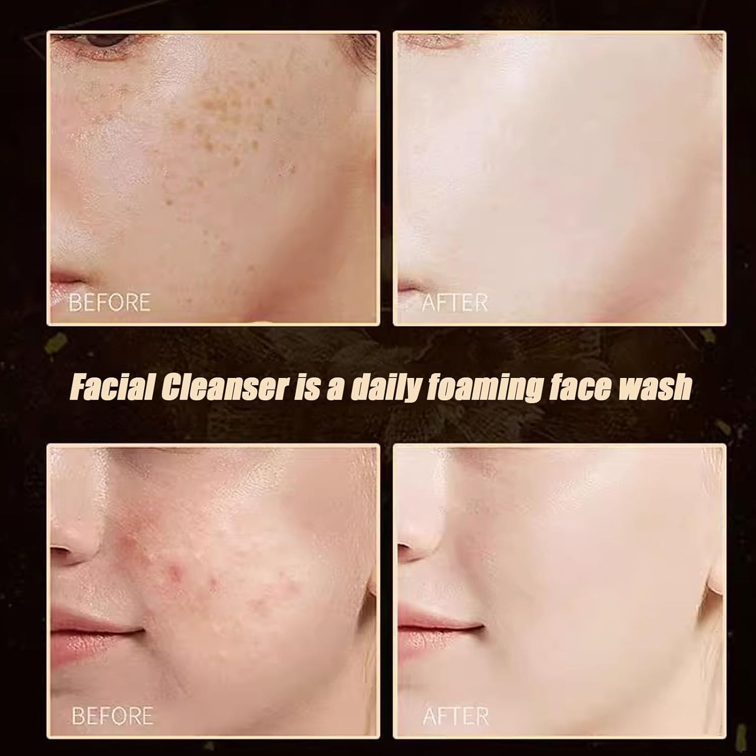 Juelreou Limpiador purificante, limpiador facial Xuerouyar, limpiador facial purificante Beautykomi, exfoliante hidratante coreano (1 unidad)