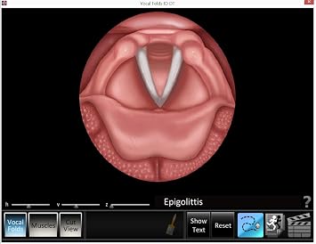 Blue Tree Publishing Larynx Poster With Software Larynx and Vocal Fold ID Speech Language Pathology, SLP, Singing
