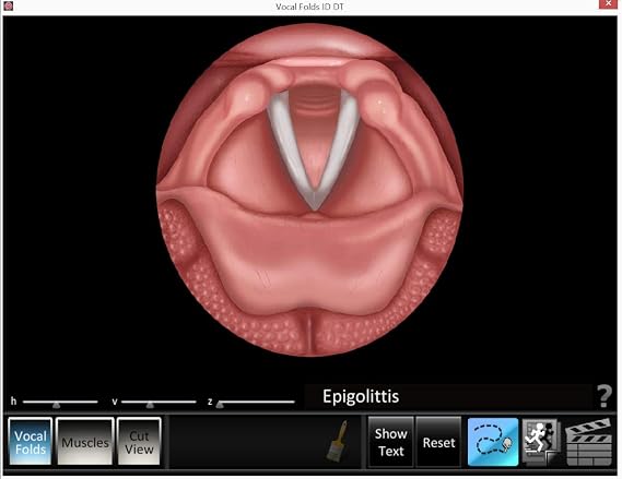 Blue Tree Publishing Larynx Poster With Software Larynx and Vocal Fold ID Speech Language Pathology, SLP, Singing