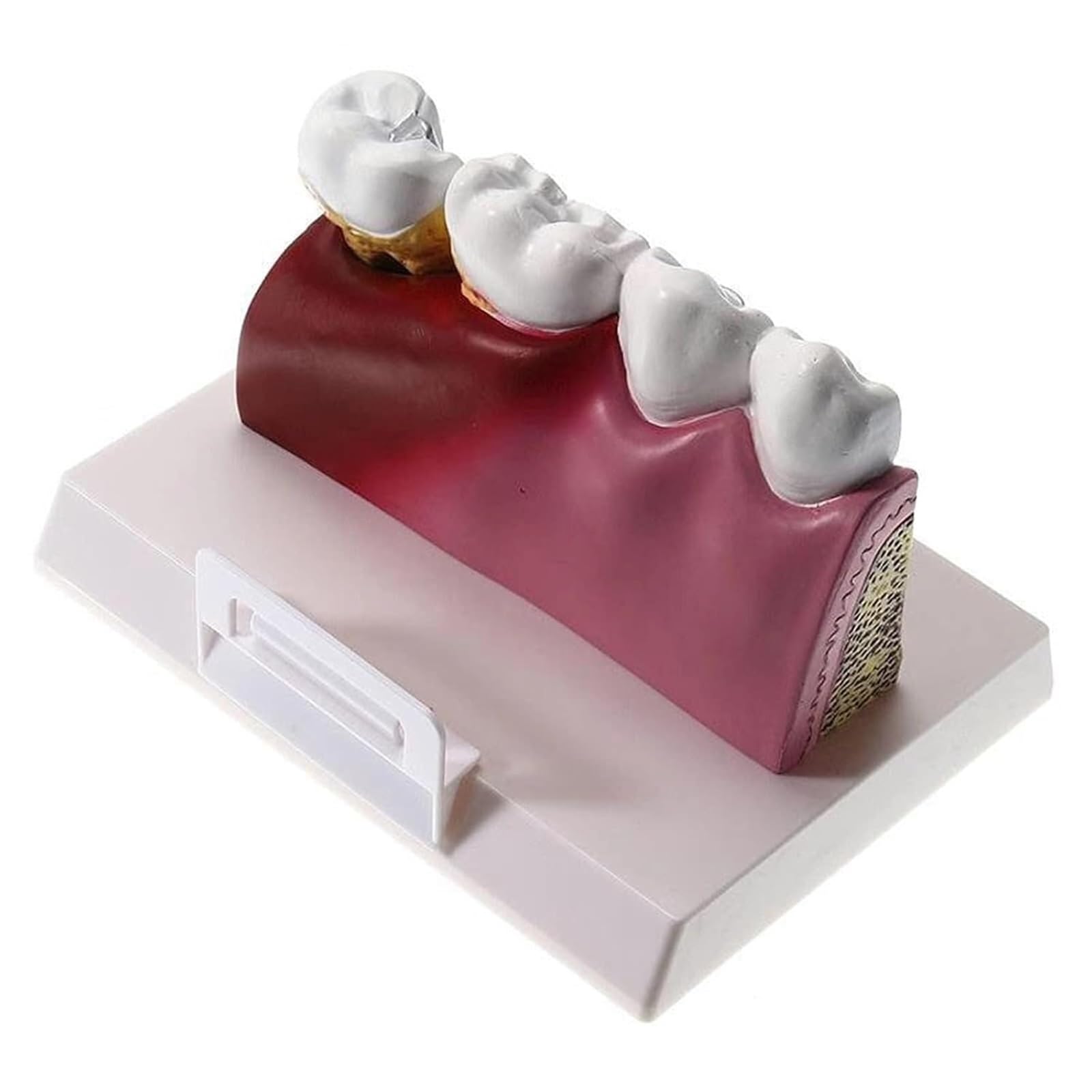 Modèle de dents d'éducation en anatomie dentaire – Modèle de section transversale des dents avec gencives dentaires amovibles pour affichage de pathologie, parfait pour les étudiants et les