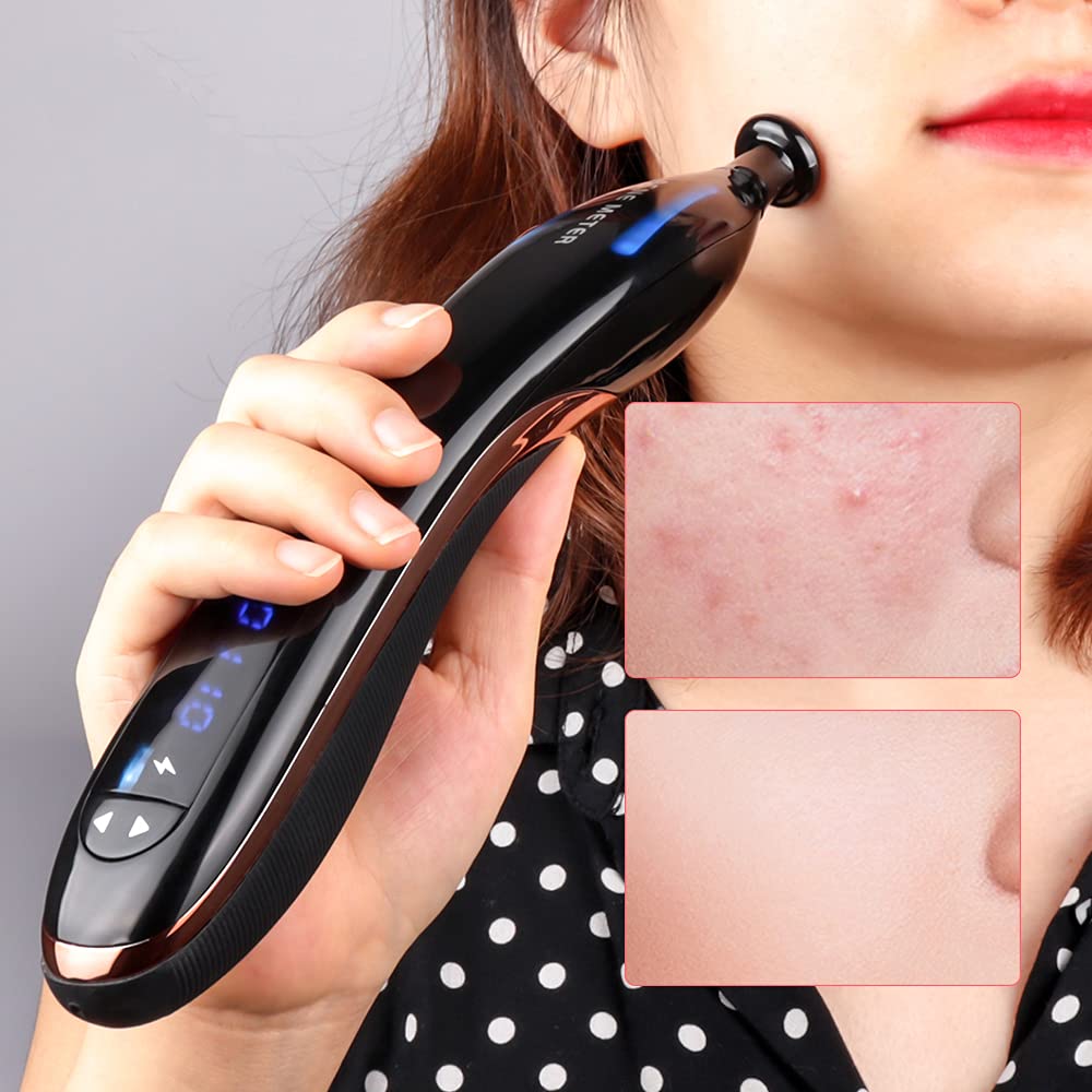 Macchina per la rimozione delle macchie dell'acne Penna al plasma Terapia antirughe per l'invecchiamento Penna per l'acne a luce blu Dispositivo di bellezza Dispositivo per la cura della pelle del v
