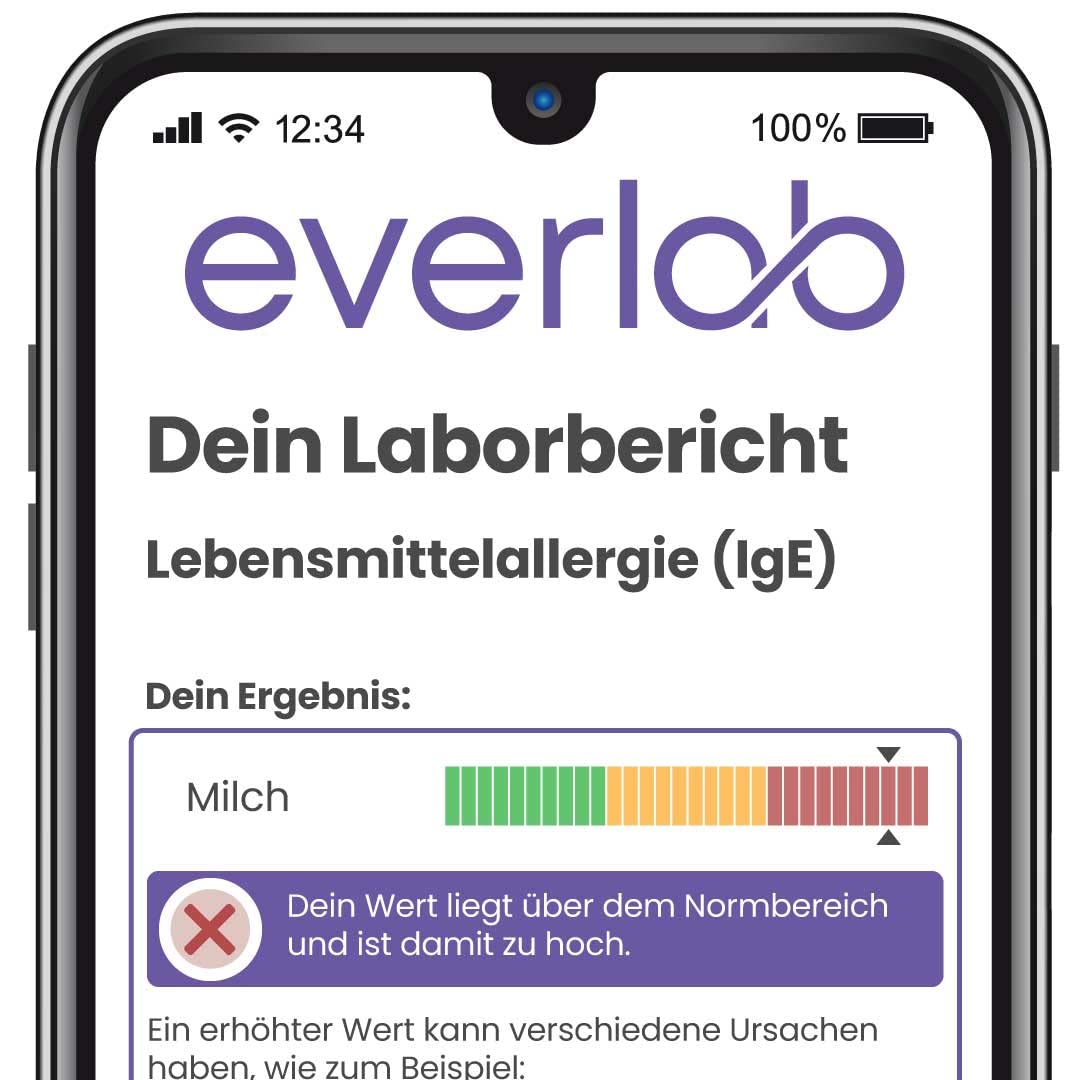 Test d'allergie au lait et aux œufs - Test IgE pour l'allergie au lait et aux œufs - Évaluation détaillée - Auto-test pour la maison