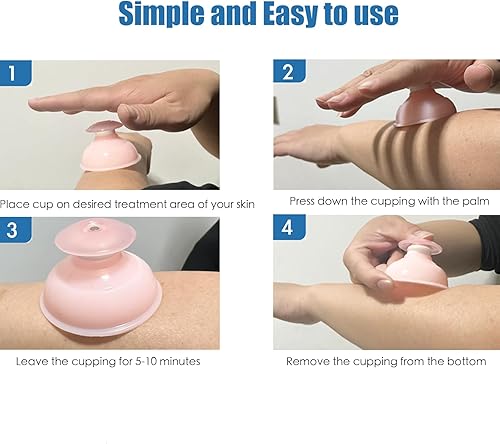 Miniatura 3 de Juegos de terapia de ventosas de silicona, 12 piezas, ventosas al vacío profesional para masaje miofascial, dolor en las articulaciones,