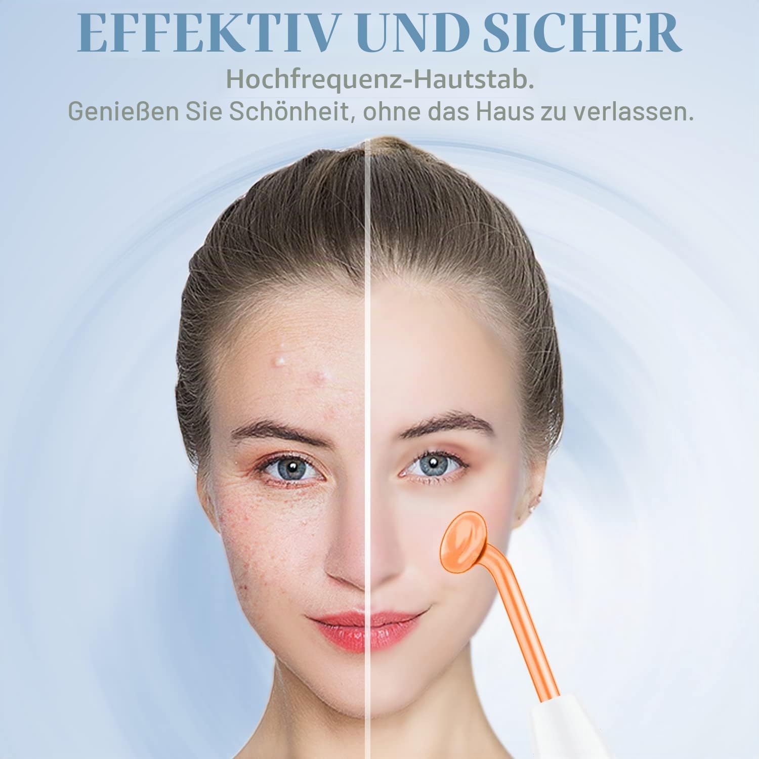 TUMAKOU Hochfrequenzstab Gesicht Hauttherapiegerät mit 4 Neon Stab Aknebehandlung Hautstraffung Faltenreduzierung