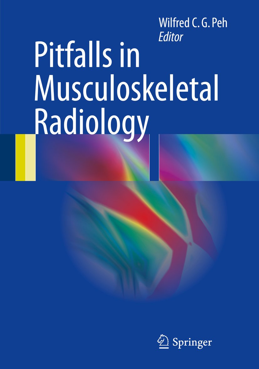 Pitfalls in Musculoskeletal Radiology (English Edition)