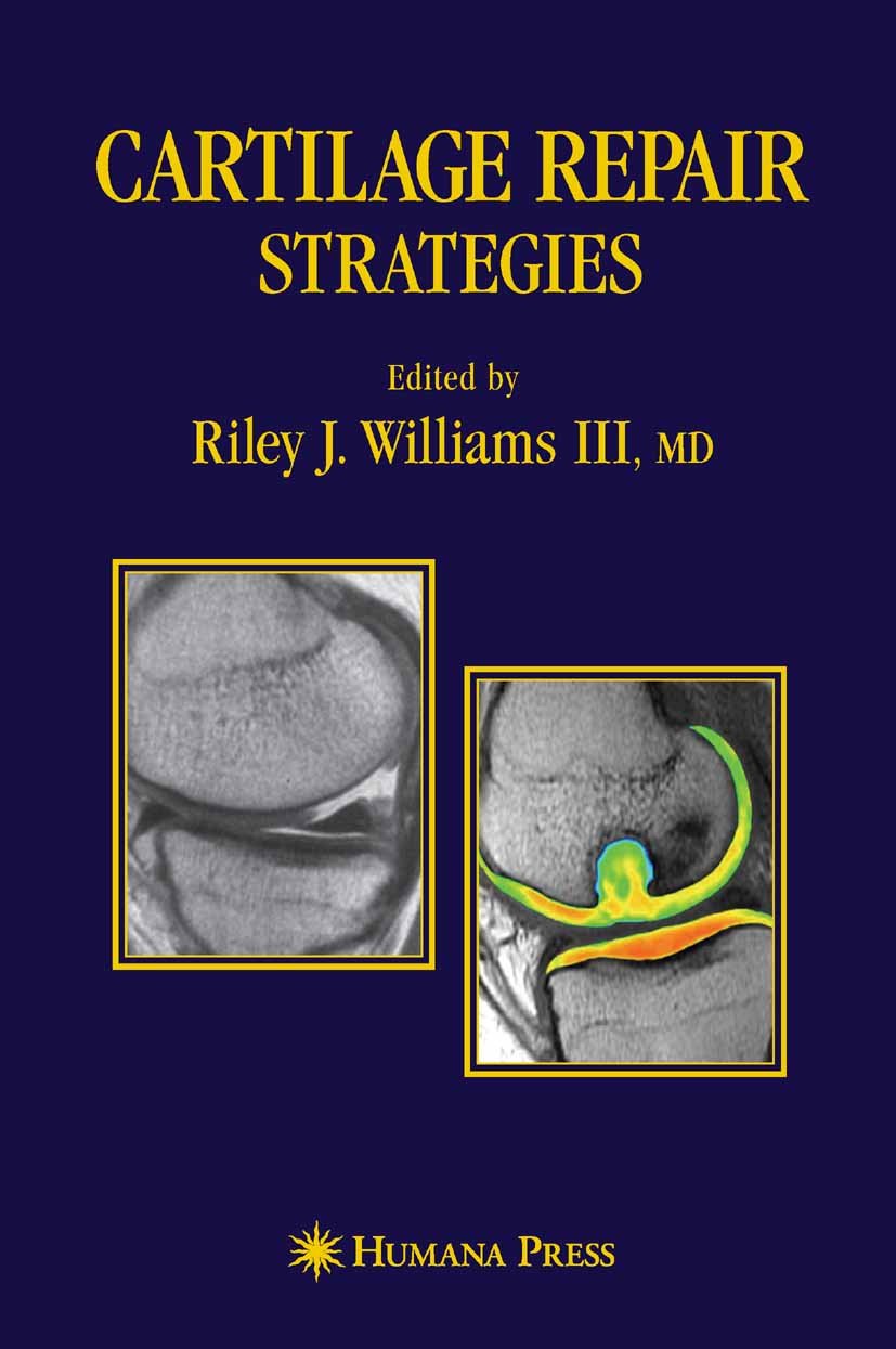 Amazon | Cartilage Repair Strategies (English Edition) [Kindle edition ...