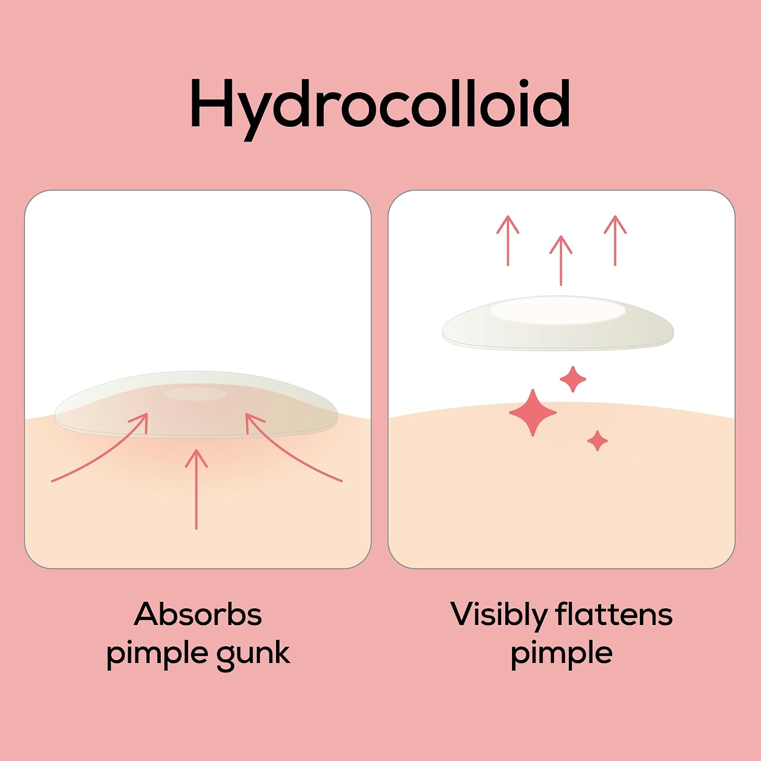 HANHOO Face & Body Blemish Patch, 6 Patch Sheets, Customizable XL Pimple Patch, Covers Clustered Pimples, For Face and Body Acne, Large Hydrocolloid Patches, Gentle Blemish Care, Korean Skincare