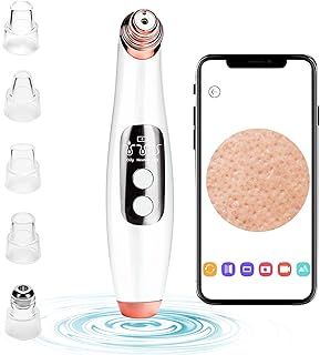 جهاز إزالة رؤوس سوداء كهربائي يعمل بالشفط مع 5 رؤوس، مناسب للنساء والرجال لتنظيف المسام وإزالة حب الشباب والرؤوس السوداء، من لونزين، لون أسود