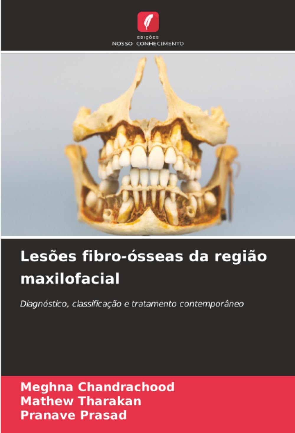 Lesões fibro-ósseas da região maxilofacial: Diagnóstico, classificação e tratamento contemporâneo
