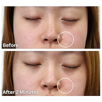 dermaflage ダーマフラージ dermaflage ダーマフラージ