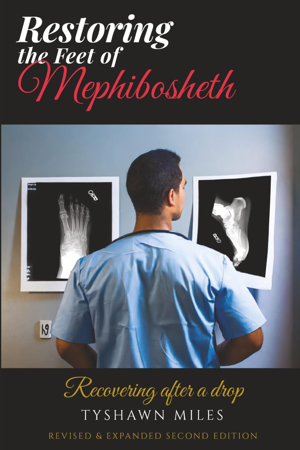 Restoring the Feet of Mephibosheth: Recovering after a drop (Revised & Expanded Second Edition)