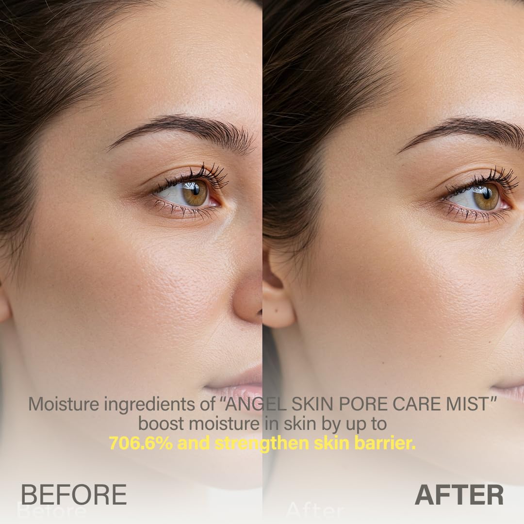 KEYTH ANGEL SKIN PORE CARE MIST (150ML, 5.07 FL.OZ.) / Sebum Control, Pore Tightening, Wrinkle Improvement, Avocado Esters, Orthosiphon Stamineus Extract