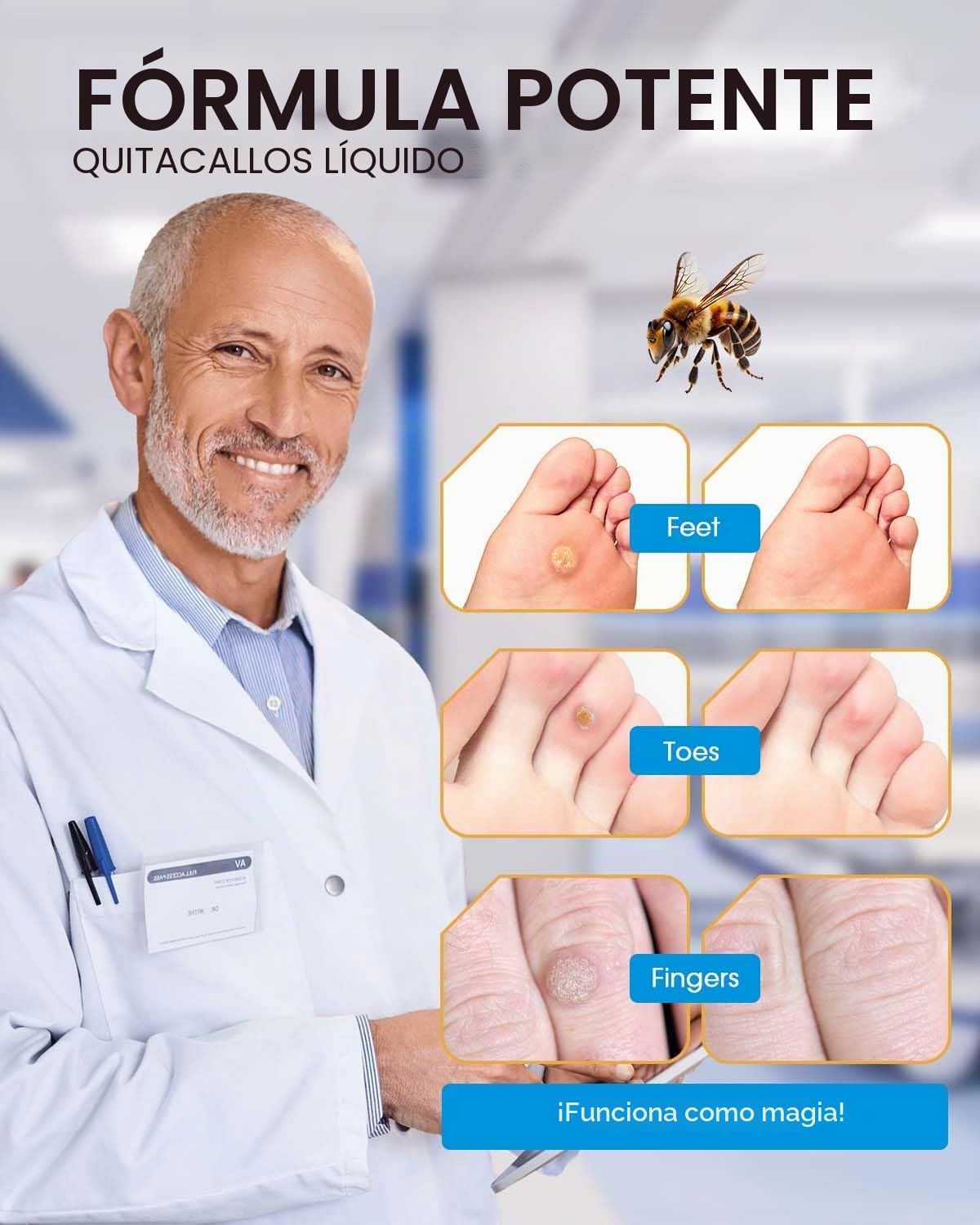 Removedor de Maíz con Veneno de Abeja, 20 ml Máxima Potencia, Eliminador de Callos Líquido para Pies, Acción Rápida, para Adultos, Personas Mayores, Adolescentes, Corredores, Senderistas