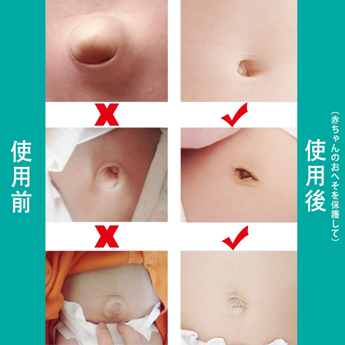 Amazon.co.jp: 2ピース赤ちゃん臍ヘルニアベルト幼児腹部バインダー