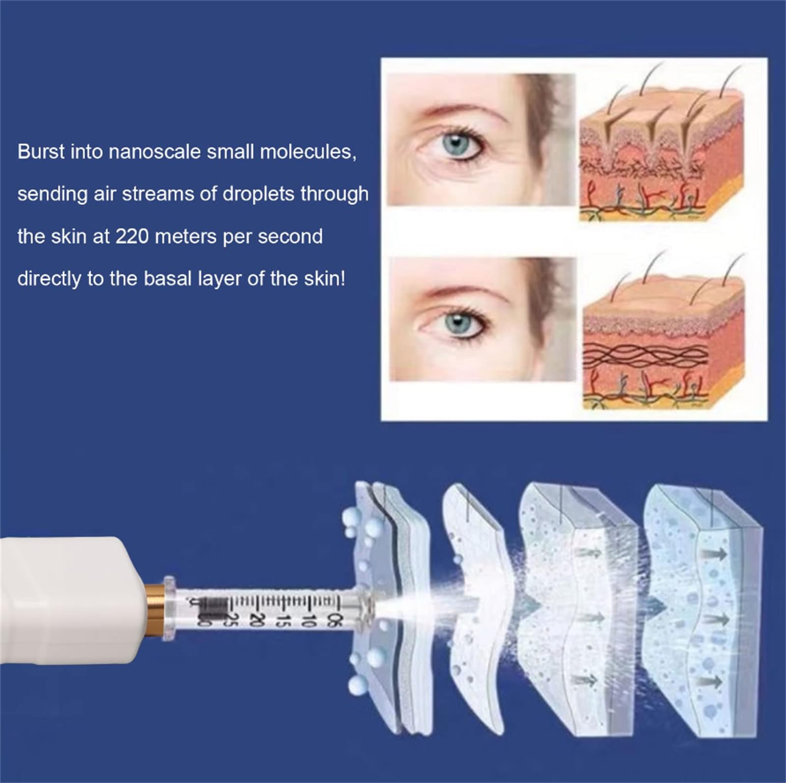 Mini Pluma De Inyección Hialurónica Dispositivo De Belleza De Inyección De Suero Facial Para Eliminación De Arrugas Para Mujeres Para El Cuidado De La Piel
