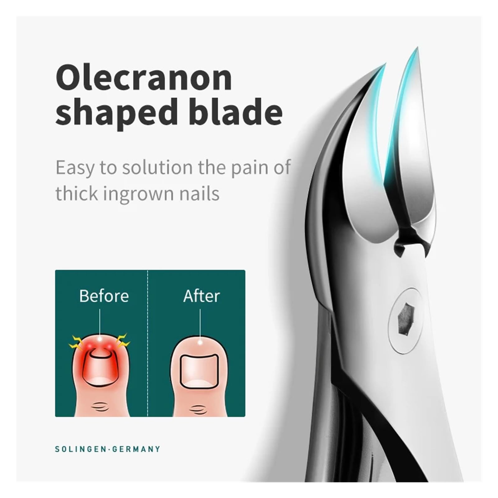 1pcs Cutters Pedicure Manicure Tools | Easy operation, home salon applicable(Mr-1033-OR-plus)