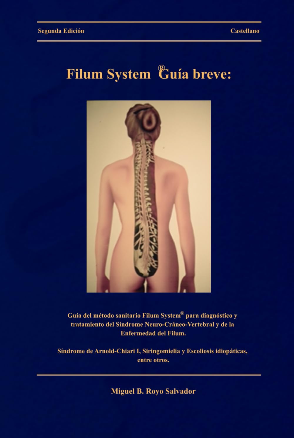 Filum System® Guía breve: Guía del método sanitario Filum System® para diagnóstico y tratamiento del Síndrome Neuro-cráneo-vertebral y de la ... y Escoliosis idiopáticas, entre otros.