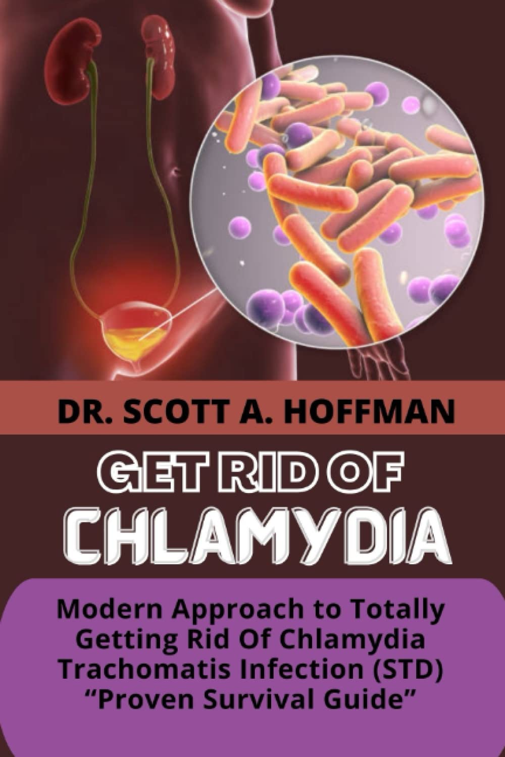 GET RID OF CHLAMYDIA: Modern Approach to Totally Getting Rid Of Chlamydia Trachomatis Infection (STD) “Proven Survival Guide”