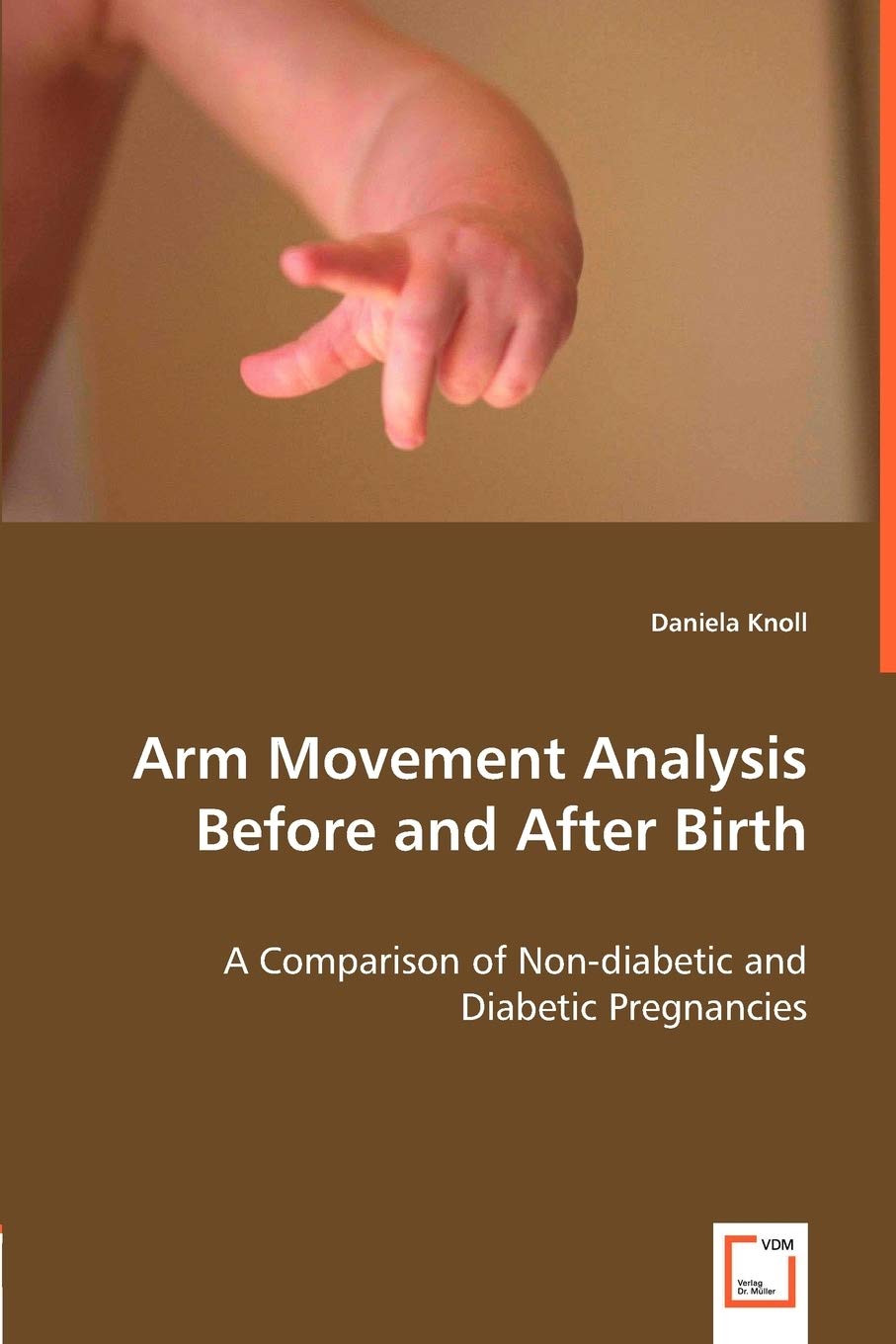 Arm Movement Analysis Before and After Birth: A Comparison of Non-diabetic and Diabetic Pregnancies