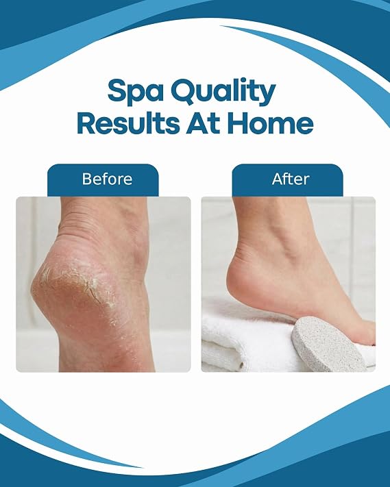 Denco Pumice Stone Callus Remover for Feet, Natural Foot Scrubber for Dead Skin Removal, Smooths Rough Dry Skin on Heels & Hands, Easy Exfoliating Stone for Home Pedicure & Foot Care