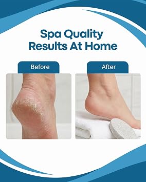Denco Pumice Stone Callus Remover for Feet, Natural Foot Scrubber for Dead Skin Removal, Smooths Rough Dry Skin on Heels & Hands, Easy Exfoliating Stone for Home Pedicure & Foot Care