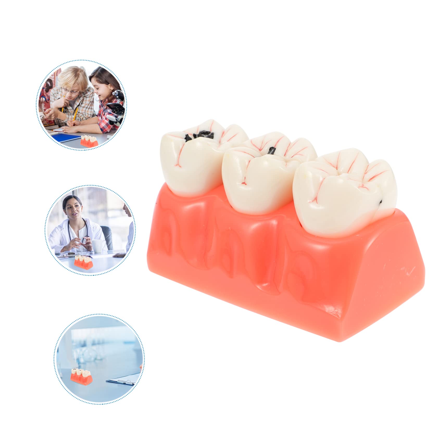Modello Anatomico dei Denti Rosa in Resina per Insegnamento | 1 Pezzo, Superficie Liscia, Uso in Classe e Dimostrazioni, Supporto Didattico per Studio Odontoiatrico