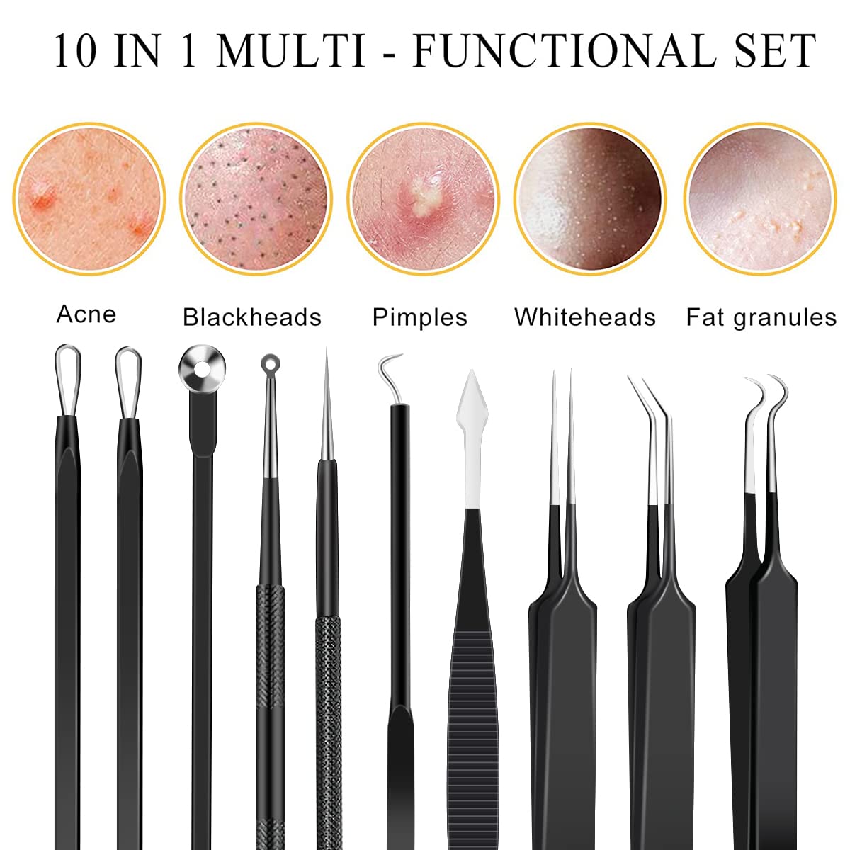 10pcs Pickel-Popper Tool Kit Edelstahl Mitesser Entferner Werkzeug Komedonen Extraktor für Stirn Gesichtsnase Leichtes Akne-Nadelwerkzeug mit Metallkoffer für Reisen Zuhause