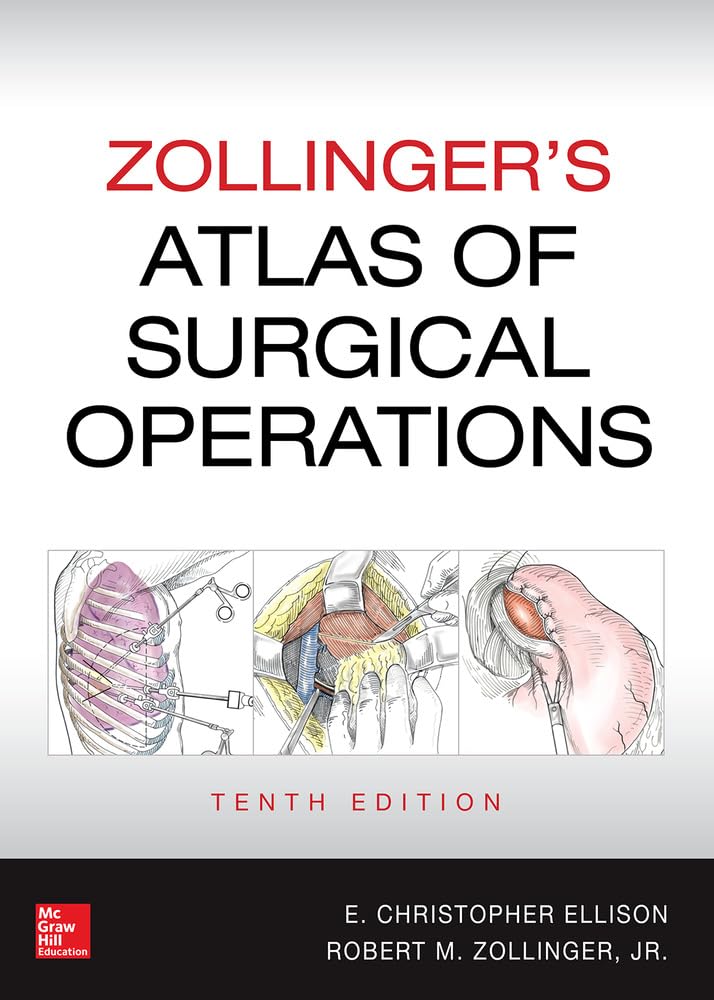健康・医学 Zollinger's Atlas of Surgical Operations Buy Zollinger's Atlas of Surgical Operations, Tenth Edition