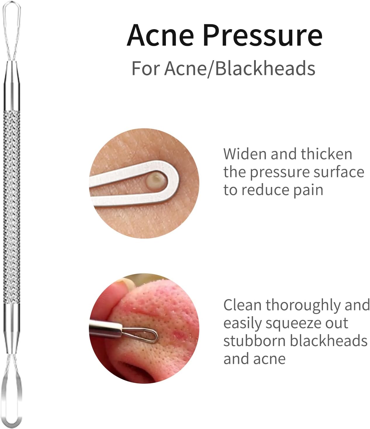 Blackhead Remover Tools,Upgrade 10 PCS Acne Needles,GERY Whitehead Removal Extractor Tools,Pimple Popper Tool Kit, Professional Stainless Pimple Acne Blemish Removal Tools Set with Leather Package