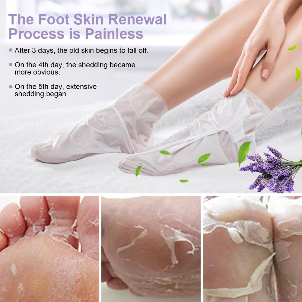 ACWOO Maschera Piedi Esfoliante, 4 paia Maschera Peeling Piedi， Maschera per Piedi Efficace Cura dei Piedi i Scrub Piedi, Maschera Esfoliante Rimozione calli e Pelle Morta piedi