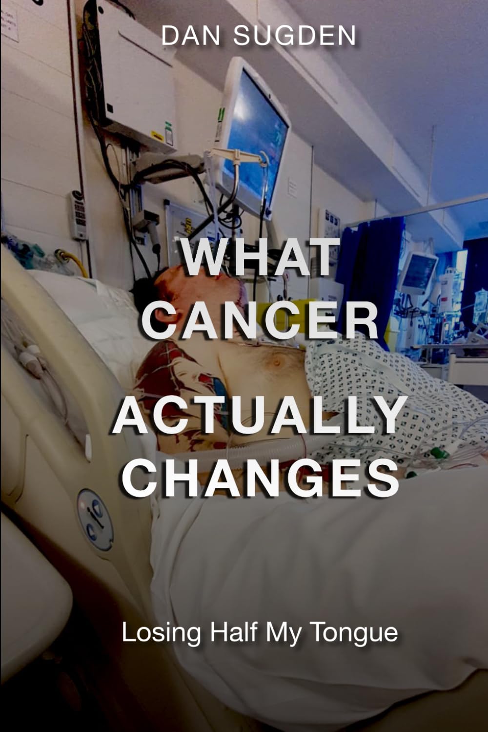 What Cancer Actually Changes: Losing Half My Tongue
