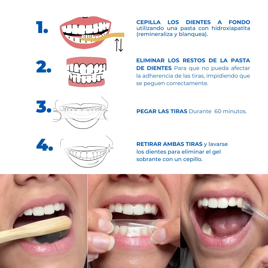 Tiras blanqueadoras de dientes PROFESIONALES FORTE - 28 tiras sin peróxido o ácidos para 14 sesiones de blanqueamiento dental - Fabricado en España - Fórmula eficaz 83.3% PAP - Incluye guía de tonos