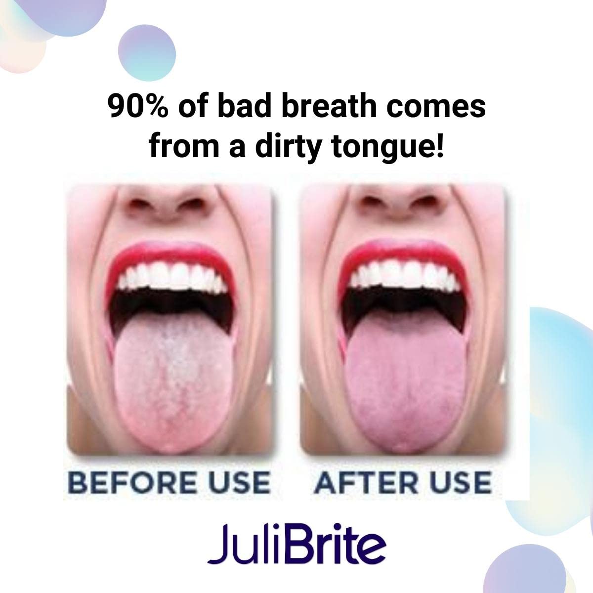 Gel lingual JuliBrite (50ML) | Ayuda a combatir el mal aliento (halitosis) | Lengua blanca | Aliento fresco | Raspador lingual | Limpiador lingual (pack de 4)