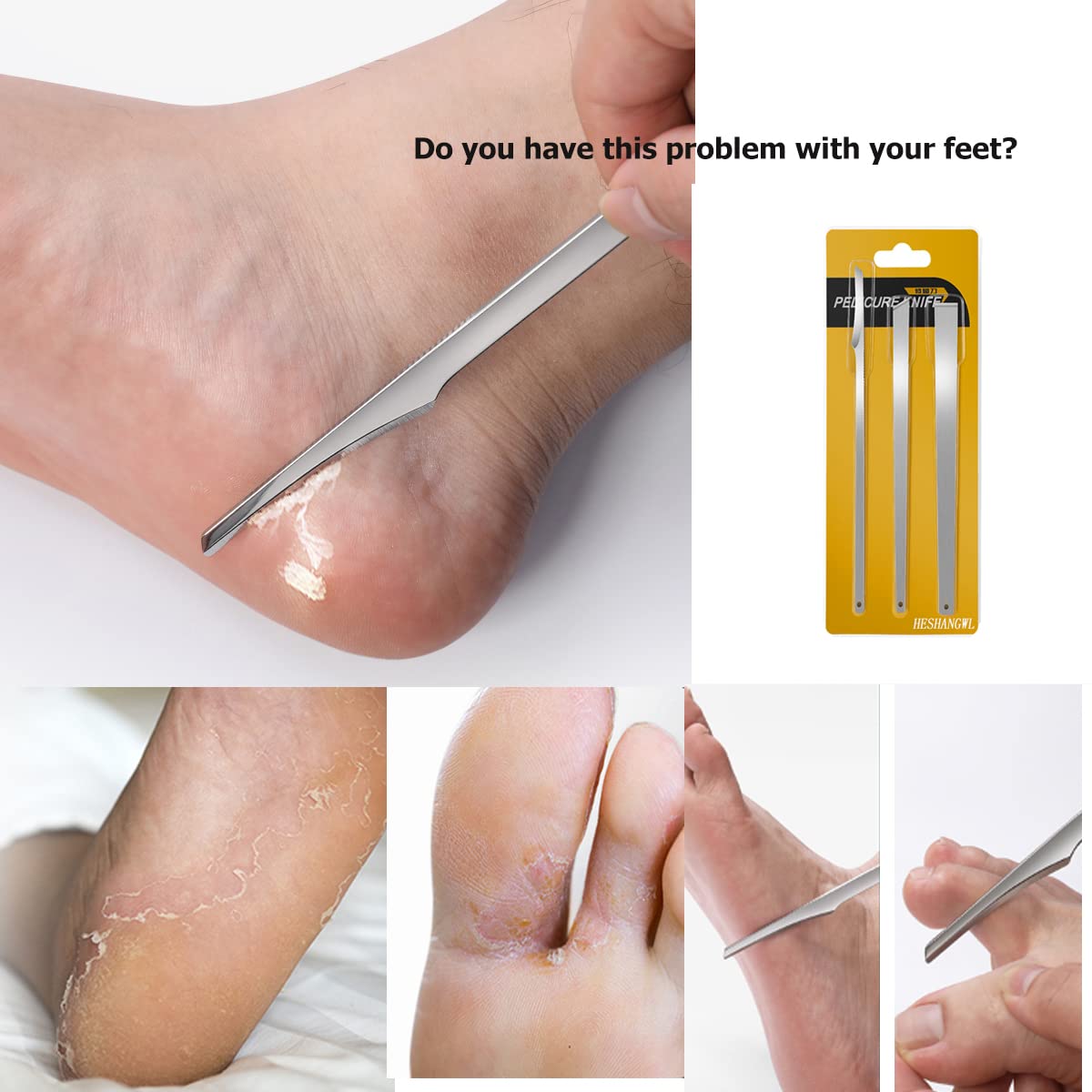 Juego de 3 cuchillos de pedicura para uñas encarnadas de acero inoxidable, raspador profesional de piel de pies, kit de hoja afilada para tratamiento de uñas, maíz, callos y paroniquia (con agujeros) 2