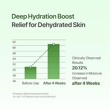 ACCOJE Reviving Gel Cream, Hydrating and Soothing Moisturizer for Sensitive Skin, Supports Skin Barrier and Reduces Visible Redness with Jeju Botanical Extracts, Korean Skincare, 1.69 fl oz