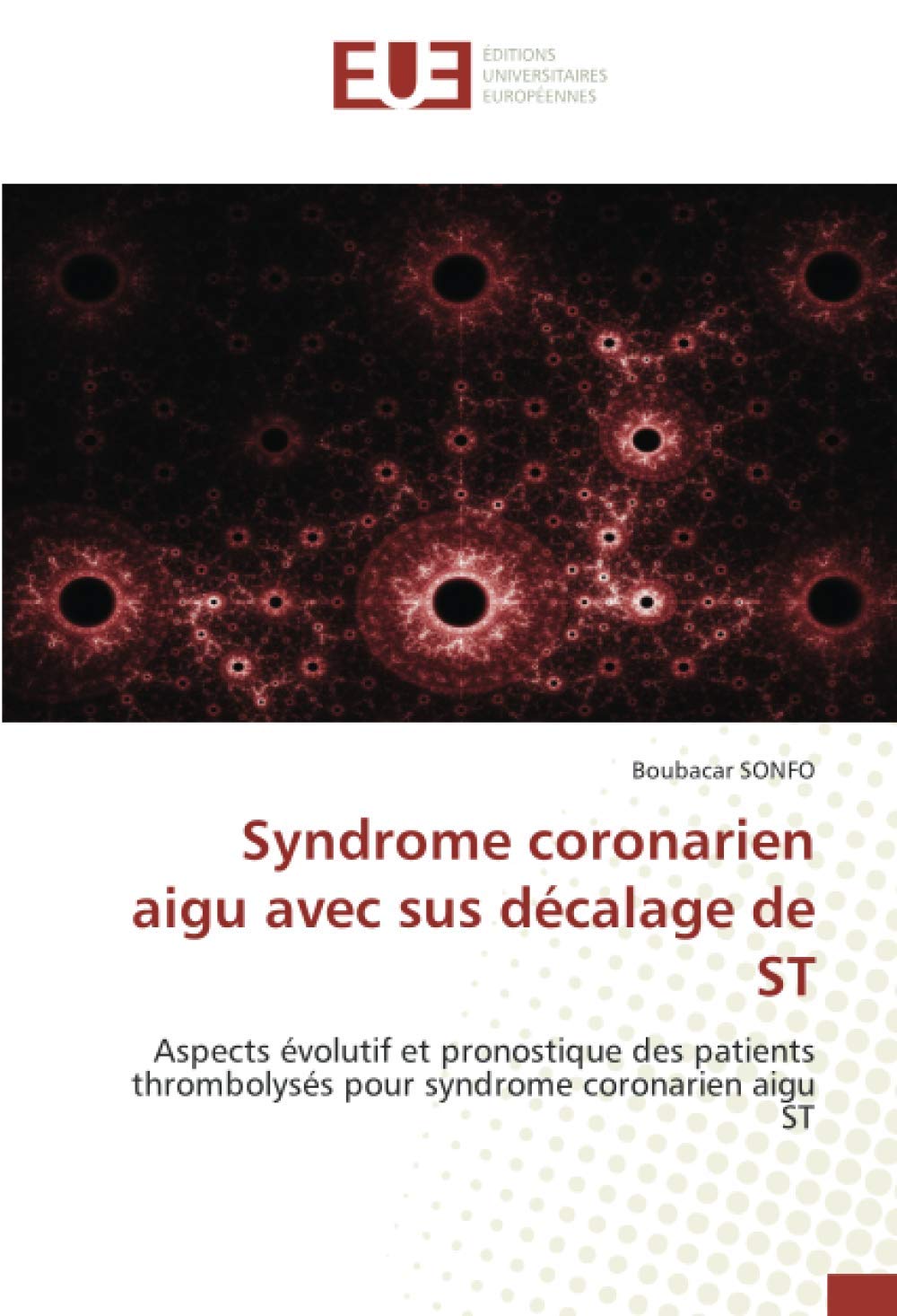 Syndrome coronarien aigu avec sus décalage de ST