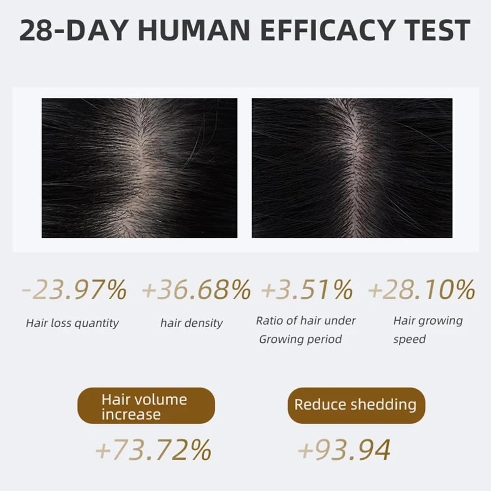 Peine EléCtrico para el Crecimiento del Cabello, AnticaíDa Cabello,con Luz Roja y Azul,Masajeador Cabelludo, Peine para el Crecimiento del Cabello, PeluqueríA por Infrarrojos
