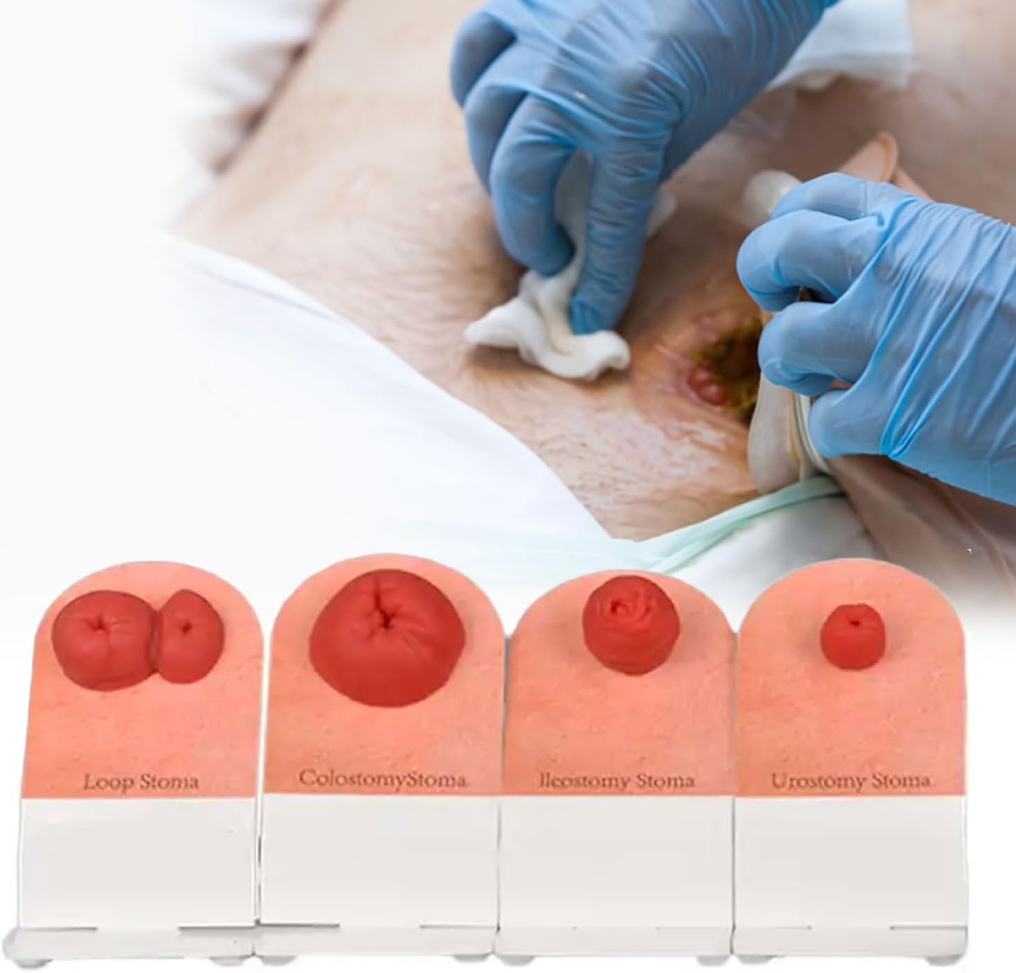HDCCDM 4pcs Ostomy Care Training Kit, Stoma Care Simulator, Tabletop Simulation Fecal Ostomy Model, Fistula Stoma Model, for Ostomy Care, First-aid Course Medical Educators