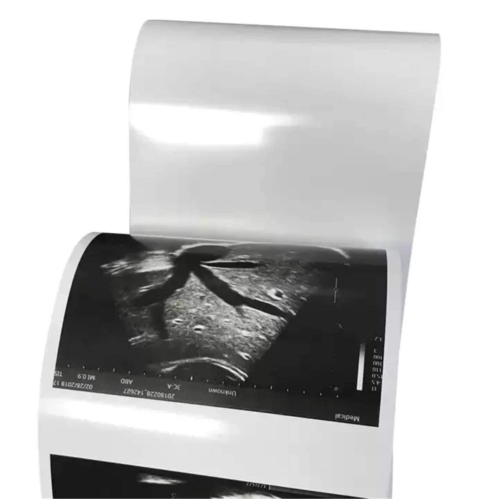 10 rotoli UPP 110HG 110 mm*18 m carta termica lucida compatibile con stampa a ultrasuoni